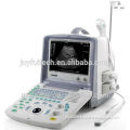 Professional electric medical equipment B/W ultrasound scan machine